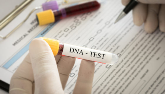 DNA-Identitätsfestellung - Verhältnismäßigkeitsgrundsatz bei der Anordnung