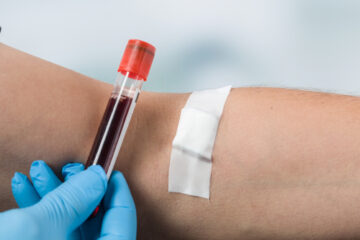 Beweiswürdigung – Berechnung der Blutalkoholkonzentration